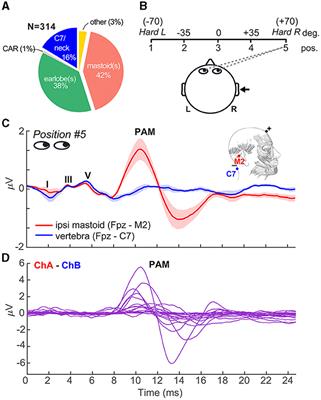 Myogenic artifacts masquerade as neuroplasticity in the auditory frequency-following response